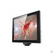 Видеоокуляр-монитор Scopepad LX97 (5 Мп, система визуализации) СТК